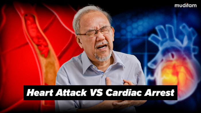 Heart Attack Vs Cardiac Arrest